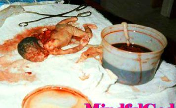 Should I have an abortion? Kabbalah on abortion